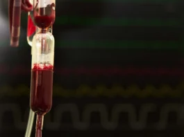 The image shows a close-up view of a blood transfusion chamber. The chamber contains a clear liquid mixed with red blood, which creates a gradient of colors from pale red to rich crimson. Small air bubbles are visible near the surface of the liquid. The transfusion chamber is vertically oriented and connected to tubes, with some appearing above and others below the chamber. The background displays blurred dark monitors with green, red, and yellow waveform patterns, typical of hospital equipment.